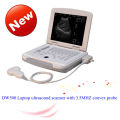 high resolution 3D 4D mini color doppler ultrasound machine DW-500